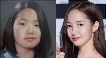 明星网红整容吸脂视频,明星网红的美丽蜕变之路