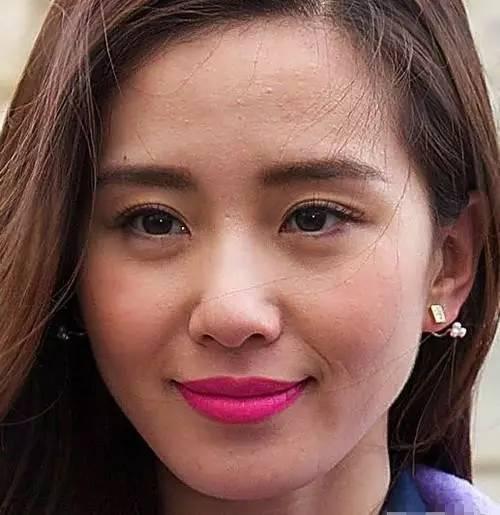 油痘肌明星网红图片,明星网红的护肤秘籍大公开